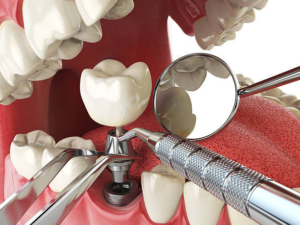 Best Weekend Emergency Dental Services in Russellville, KY